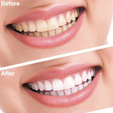 Veilig Tanden Bleken Thuis | Professionele Tandenbleekset | Zelf tanden bleken